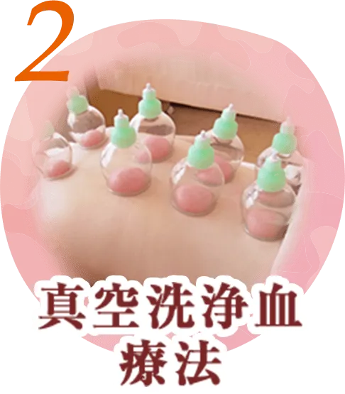 真空洗浄血療法